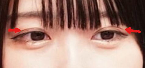 アイプチのシワ画像